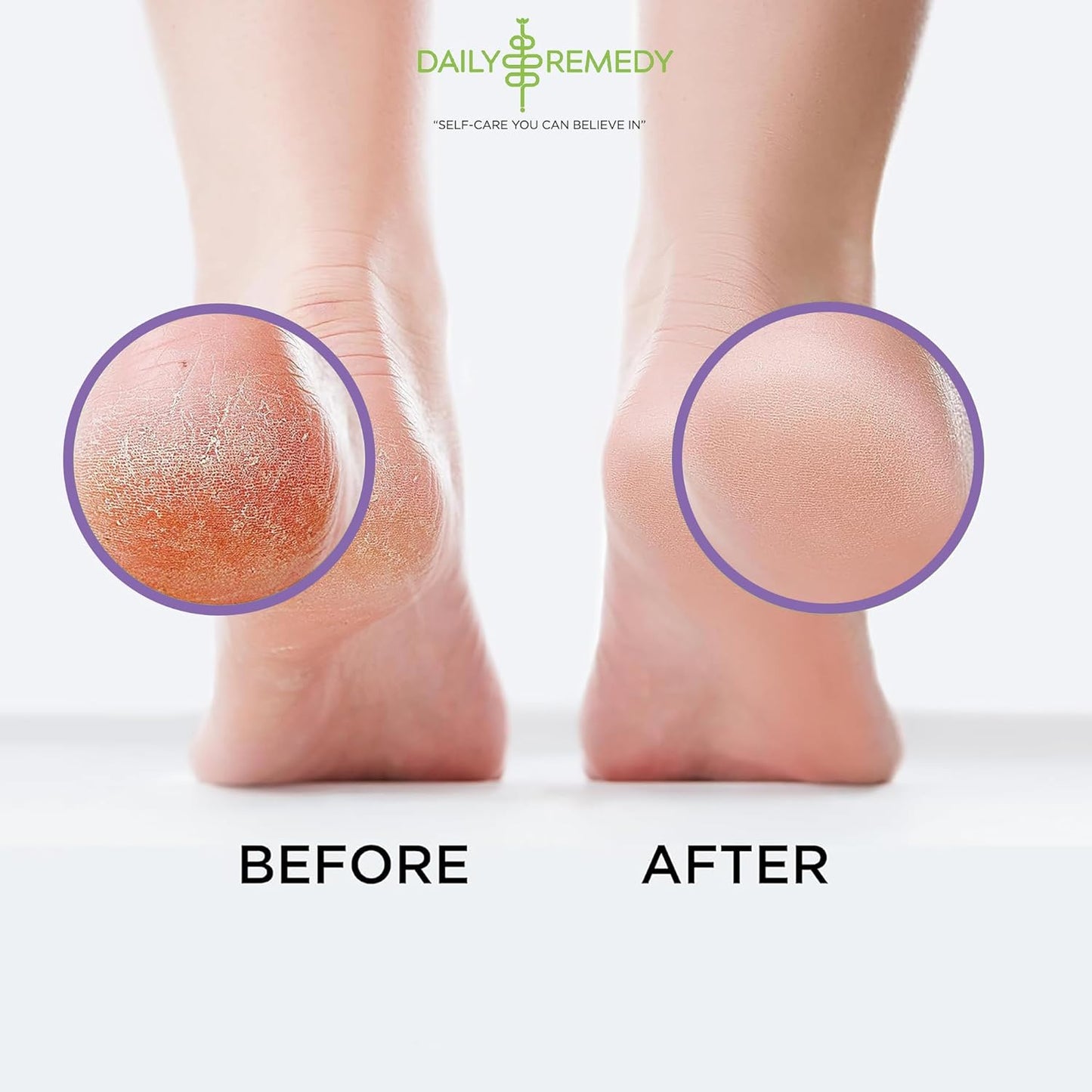 Calming Lavender Foot Soak with Epsom Salt - 2 PACK -Foot Soak Soothes Sore Tired Feet, Athletes Foot & Remove Foot Odor. Best Foot Spa Pedicure Set