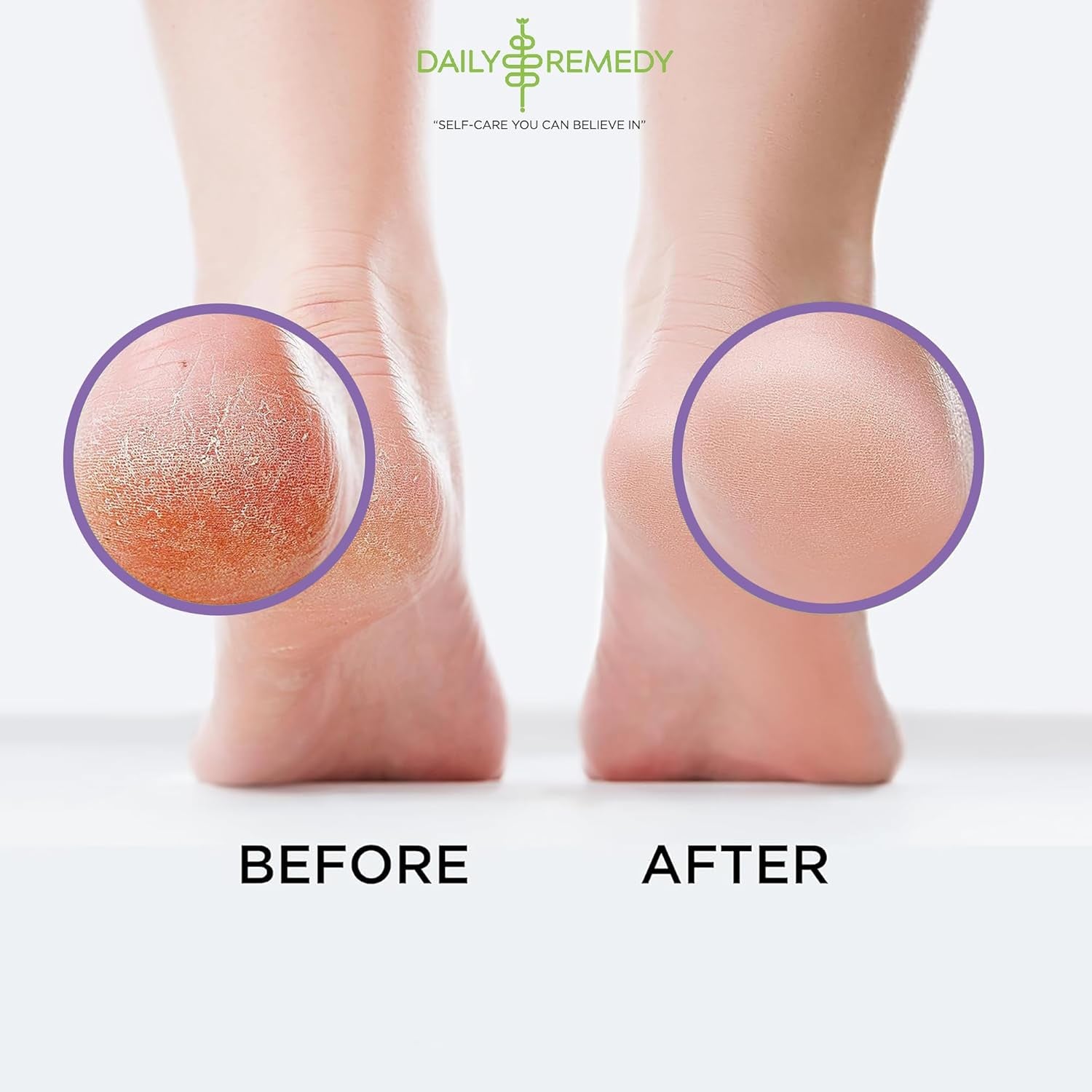 Calming Lavender Foot Soak with Epsom Salt - 2 PACK -Foot Soak Soothes Sore Tired Feet, Athletes Foot & Remove Foot Odor. Best Foot Spa Pedicure Set