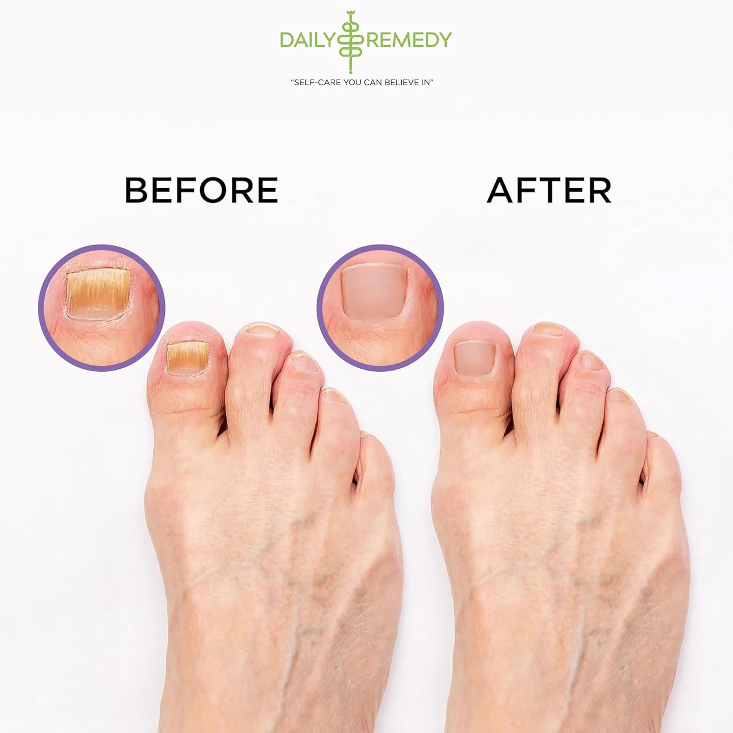 Calming Lavender Foot Soak with Epsom Salt - 2 PACK -Foot Soak Soothes Sore Tired Feet, Athletes Foot & Remove Foot Odor. Best Foot Spa Pedicure Set