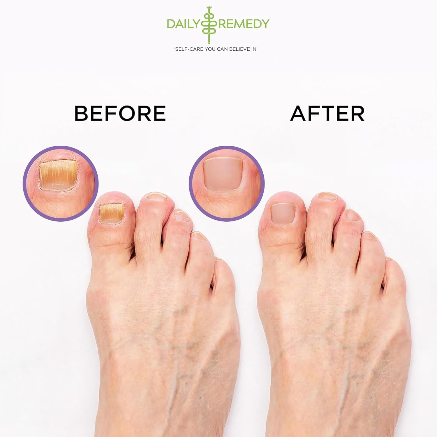 Calming Lavender Foot Soak with Epsom Salt - 2 PACK -Foot Soak Soothes Sore Tired Feet, Athletes Foot & Remove Foot Odor. Best Foot Spa Pedicure Set