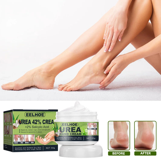 Frankincense Oil Foot Cream - Fight Soreness and Stiffness in Tired Feet - Foot Sole, Achilles, Foot Bridge, Ankle and Foot Hill