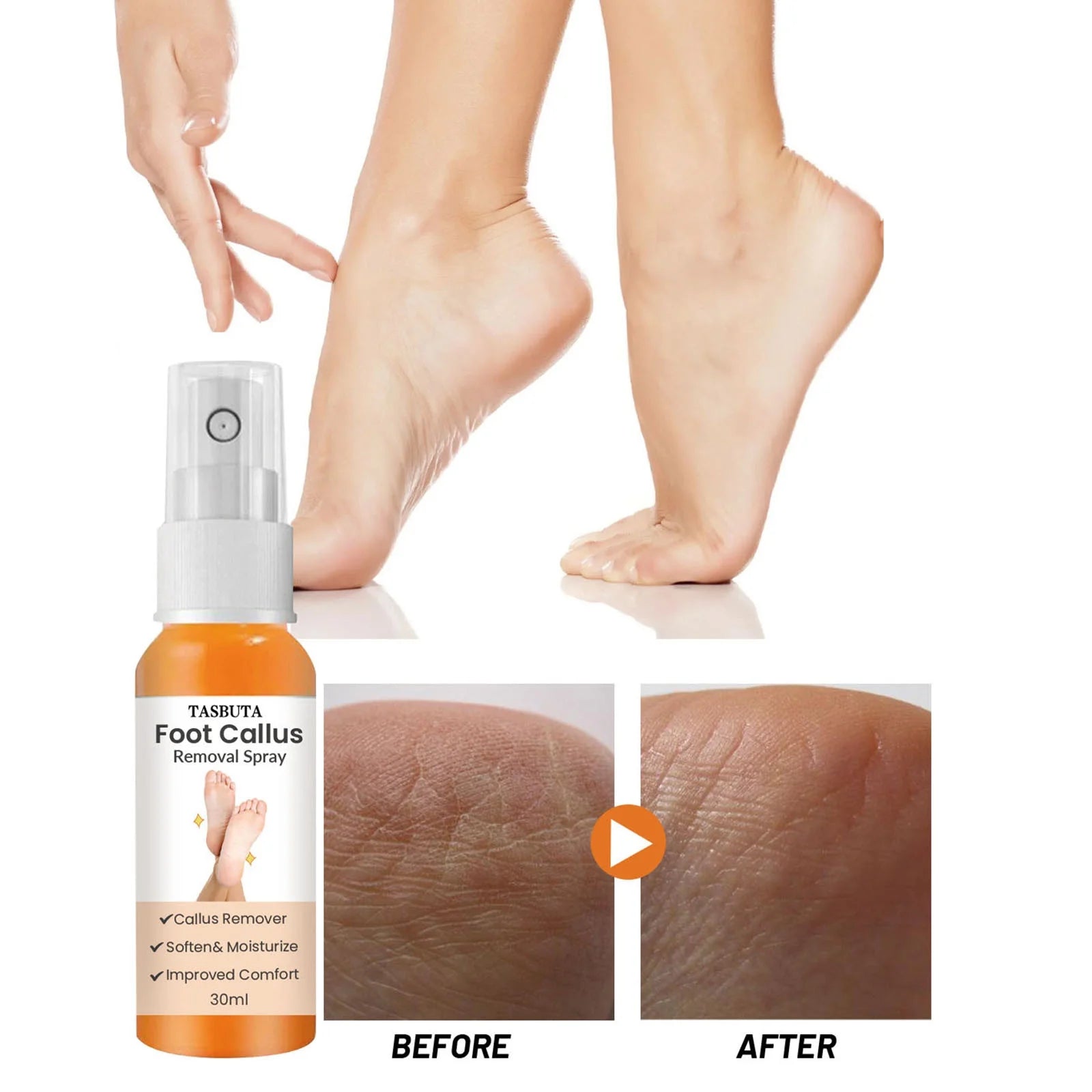 Foot Callus Removal Spray，Foot Peeling Spray Orange Oil,Foot Peeling Spray That Dead Skin within Seconds 30Ml Foot Cream
