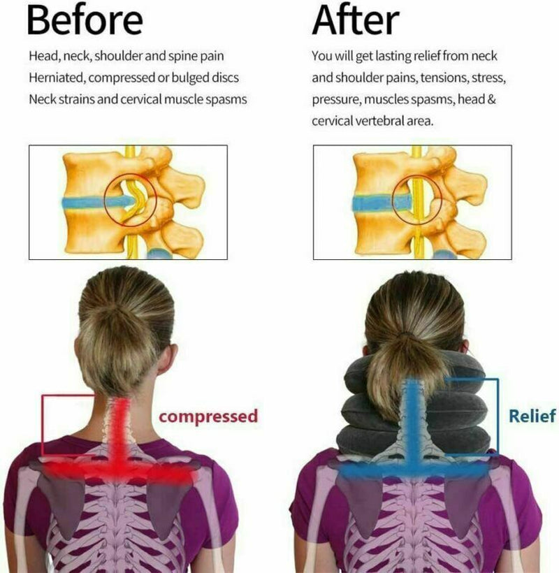 Cervical Neck Traction Device Collar Brace Support Pain Relife Stretcher Therapy