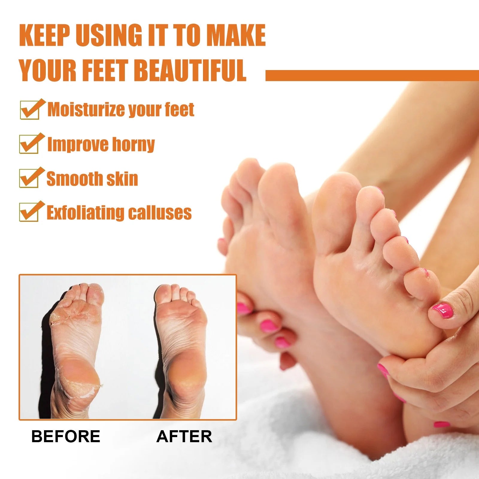 Foot Callus Removal Spray，Foot Peeling Spray Orange Oil,Foot Peeling Spray That Dead Skin within Seconds 30Ml Foot Cream