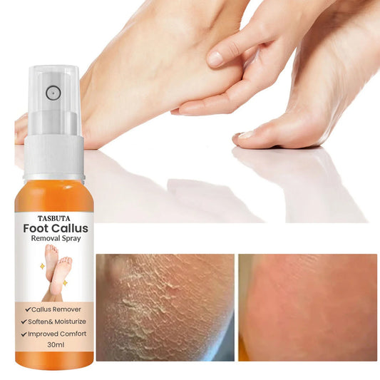 Foot Callus Removal Spray，Foot Peeling Spray Orange Oil,Foot Peeling Spray That Dead Skin within Seconds 30Ml Foot Cream