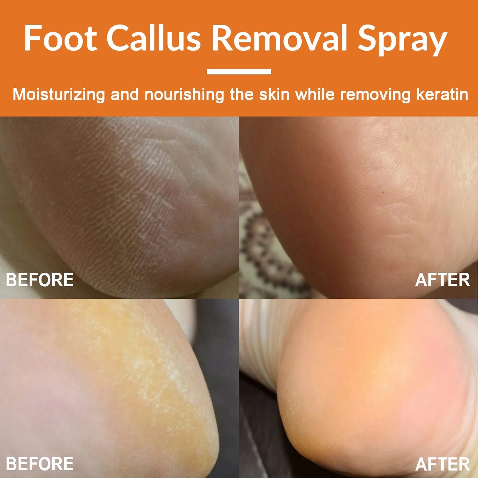 Foot Callus Removal Spray，Foot Peeling Spray Orange Oil,Foot Peeling Spray That Dead Skin within Seconds 30Ml Foot Cream
