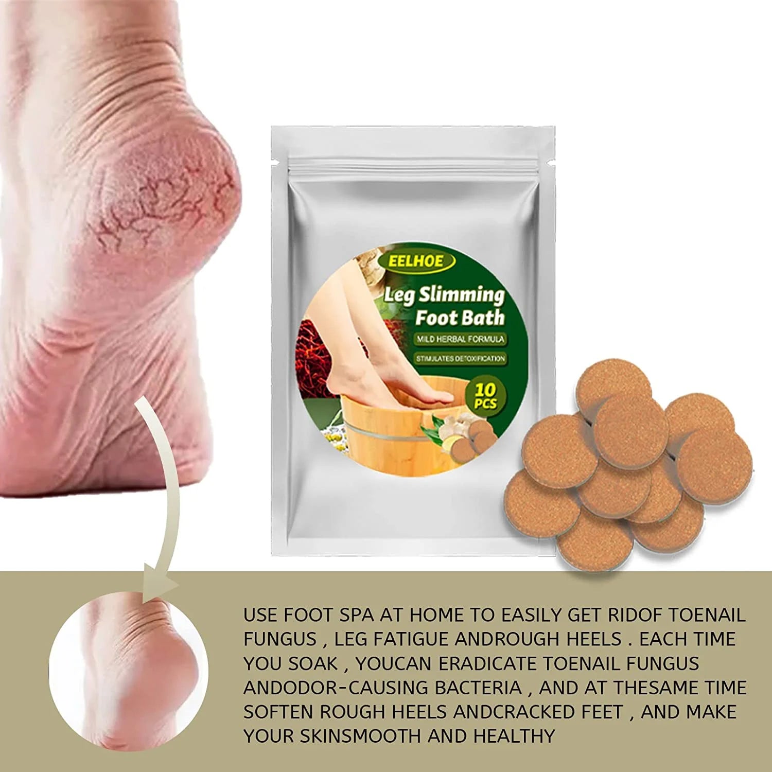 Lymphatic Drainage Ginger Foot Soak, Turmeric Lymphatic Detox Foot Soak, Natural Mugwort Herb Foot Soak, Leg Slimming Foot Bath, Foot Reflexology Spa Relax Massage (70Pcs)