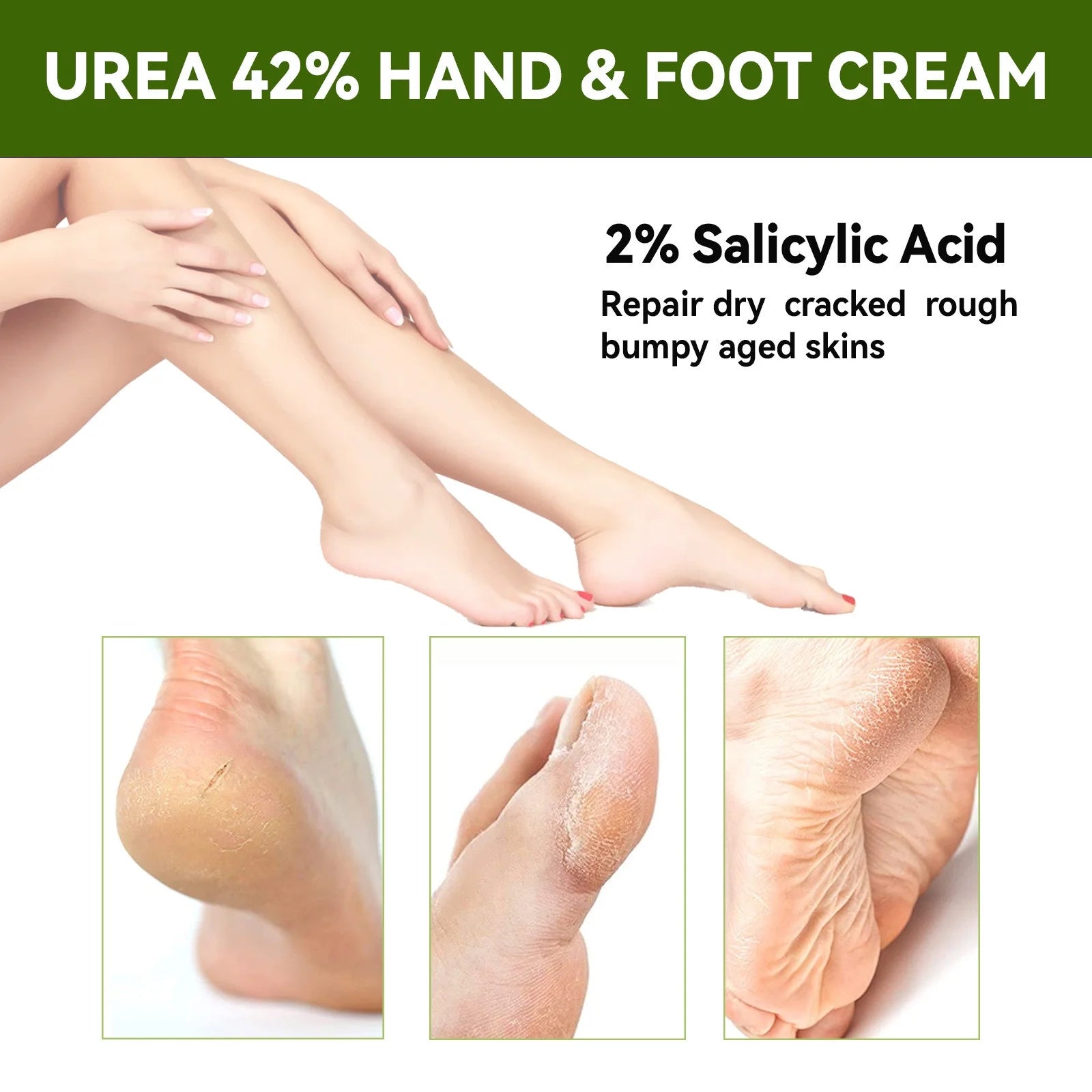 Frankincense Oil Foot Cream - Fight Soreness and Stiffness in Tired Feet - Foot Sole, Achilles, Foot Bridge, Ankle and Foot Hill